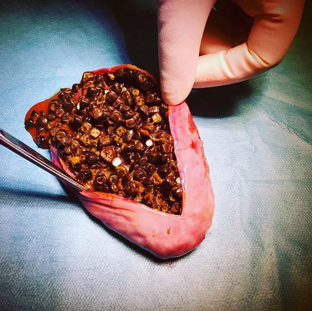 1786964536_gallbladder.webp