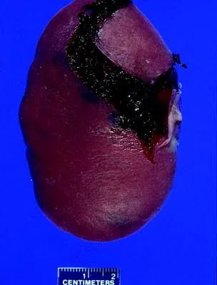 1786964837_spleen.webp