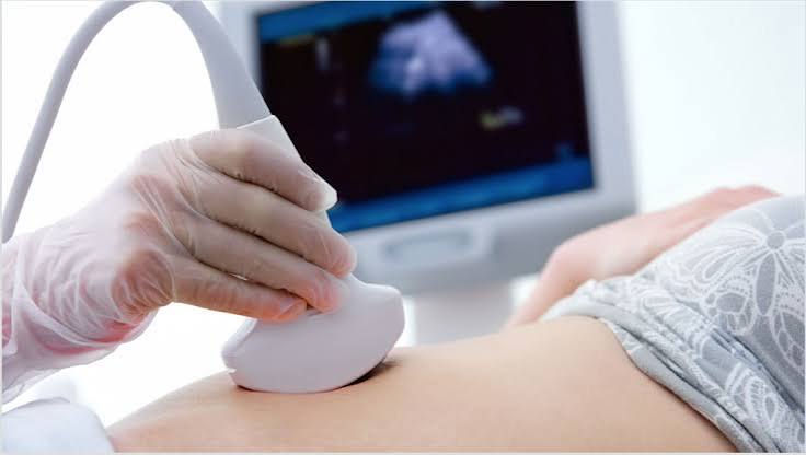 sono-appendicitis